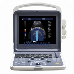 4D Ultrasound machine