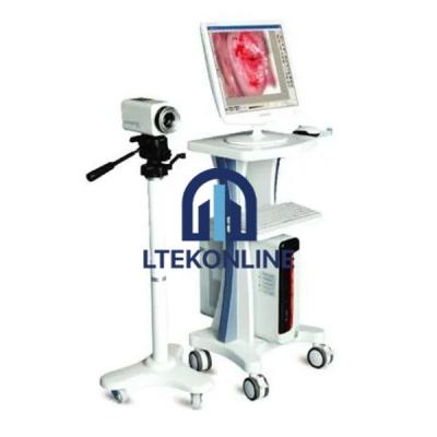 Digital Video Colposcope For Gynecology