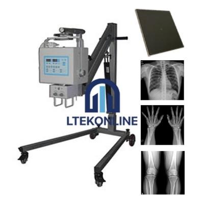 Hospital Digital Portable X Ray Machine